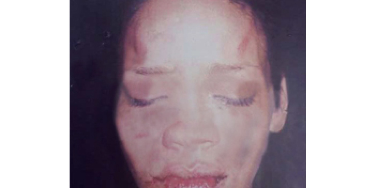 Rihanna tras ser maltratada por Chris Brown